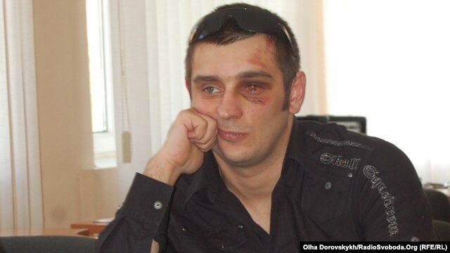 Donetsk journalist Artyom Furmanyuk says he was beaten by the police.