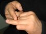 Kazakhstan - Takhirzhan Akhmetov prepares to cut the second finger, Almaty, 09Feb2009