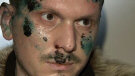 Adam Osmayev shortly after his detention
