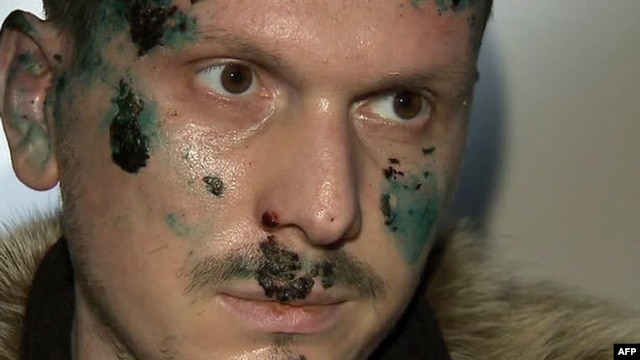 Adam Osmayev is suspected of conspiring to kill Vladimir Putin. (Screen grab from Russian TV)