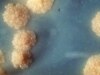 Syringe Snag Could Leave Tajik Infants At TB Risk