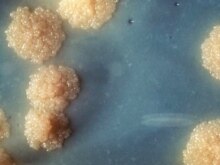 United States -- Mycobacterium tuberculosis bacterial colonies  - 1976