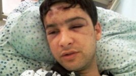 8 мая. Далер Шарипов на больничной койке в Кара-Боло