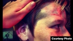 One of the victims of an attack on a gay bar in Moscow last week.