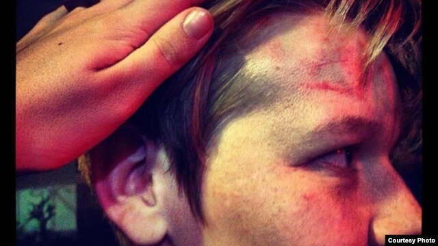 One of the victims of an attack on a gay bar in Moscow last week. 