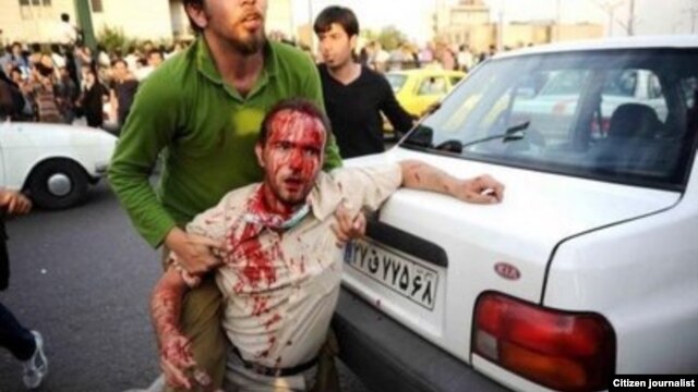 Dozens have been injured in the clashes