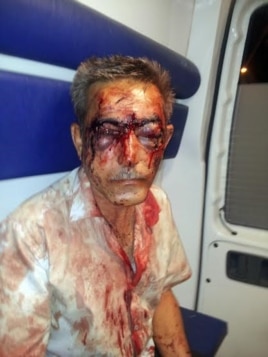 Journalist İlgar Nasibov was brutally beaten in August.