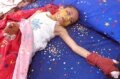 پسری دانش آموزی که از ناحیه دست و صورت دچار سوختگی شدید شده است.
