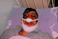 Kenzhegali Aitbakiev after he was attacked on April 23 (RFE/RL)