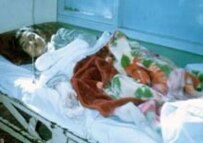 An Afghan woman in hospital after attempting self-immolation (file photo) (RAWA)