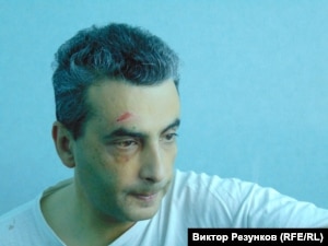 Лев Шлосберг в больнице