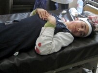 A girl in Kirkuk who was wounded by an insurgent bomb in April (epa)