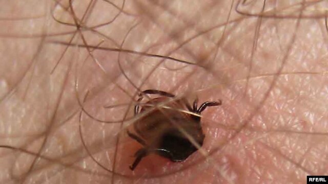 Порнодағы әйелі Порно қынап саусақпен жақыннан ашылады