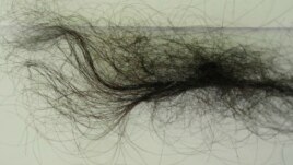 Эшонқулова сўзларига кўра, бу пикет пайти номаълум аёллар юлиб олган унинг соч толаси.