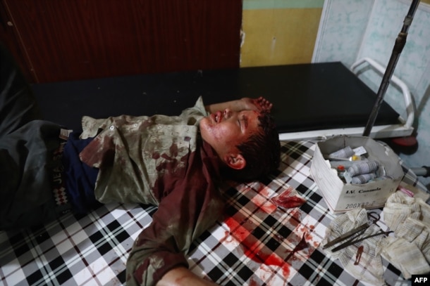Раненый сирийский ребенок в больнице после авиаударов
