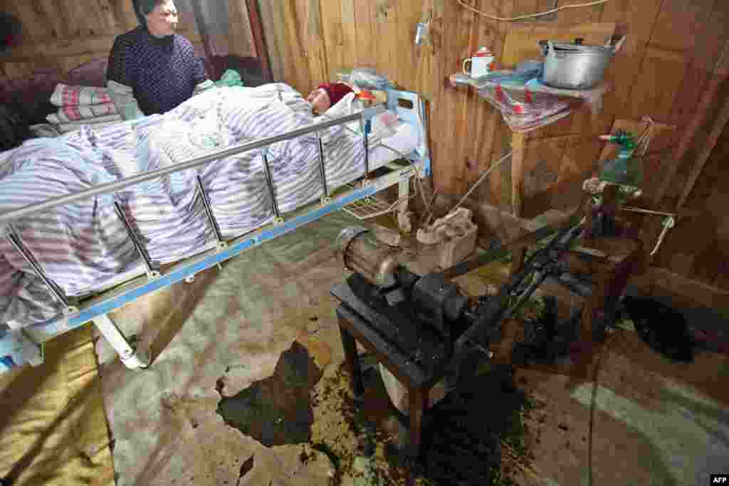 Fu Xuepeng, who was paralyzed in a road accident when he was 23, breathes with the aide of a homemade ventilator while his mother, Wang Lanqin, looks on at their home in China's Zhejiang Province. A local hospital has decided to help Fu's parents after reports they have kept their son alive for more than five years using a hand-pumped resuscitator bag and a ventilator made by a local do-it-yourself expert. They took turns compressing their son's bag 24 hours a day, seven days a week, until someone made them a ventilator. To minimize the electricity bill, the couple still compresses the bag by hand during the day and turns on the machine only at night. (AFP)