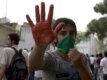 A protester shows a bloodied hand after the clashes.