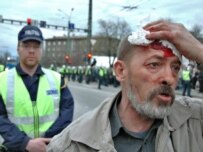 A man injured on April 26 demonstrating against removal of the war memorial (ITAR-TASS)