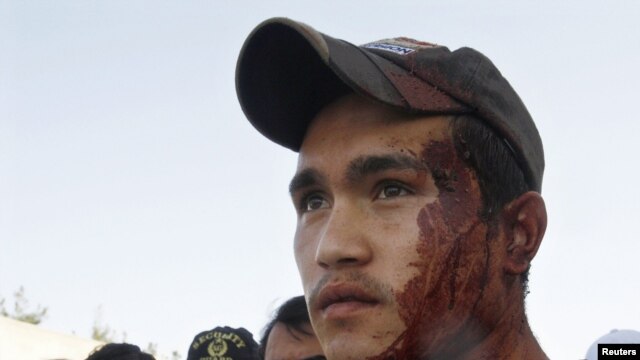 An ethnic Hazara Shi'a is smeared in blood after bringing victims of a shooting to a local hospital in Quetta in May 2011.