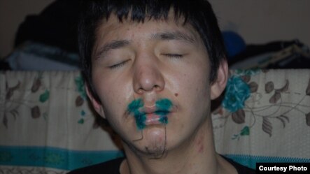 One of the more than 1,000 prisoners across Kyrgyzstan's penitentiary system who sewed his lips together in protest.