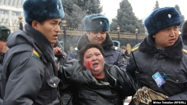 Doctors say Jyparkan Omurova sustained second- and third-degree burns but her life is not in danger.