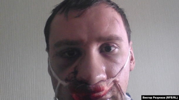 Егор Алексеев после избиения