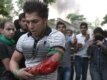 Iranian media reported that seven people were killed in the clashes. This demonstrator suffered a gunshot wound.