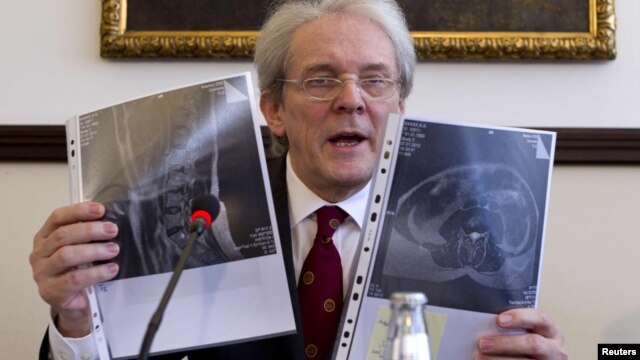 The head of Germany's Charite-University Hospital, Karl Max Einhaupl, and other German doctors examined Tymoshenko on February 28.