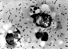 Бактерия бубонной чумы