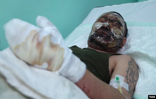 Бурятский танкист Доржи Батомункуев - еще один россиянин, раненый в боях за Дебальцево