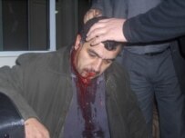 Jafarov following the attack on him