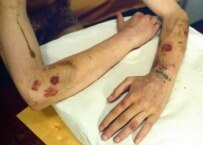 A drug-using, AIDS-infected prisoner in Russia (ITAR-TASS)