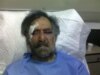 Popular Syrian Cartoonist Attacked  