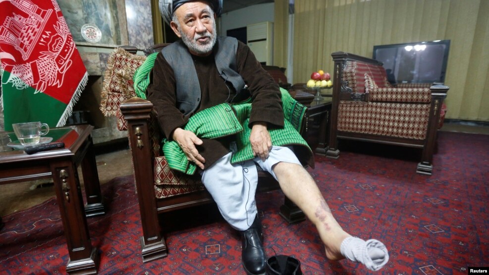 Ahmad Ishchi displays an injury on his leg during an interview at his home in Kabul on December 13.