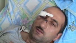 Azerbaijan -- Idrak Abbasov, a Zerkalo correspondent, was hospitalized in Baku yesterday with a concussion and injuries.  19Apr2012
