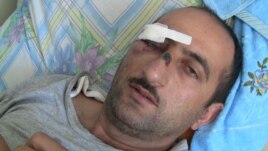 Journalist Idrak Abbasov was beaten by state security agents in April.