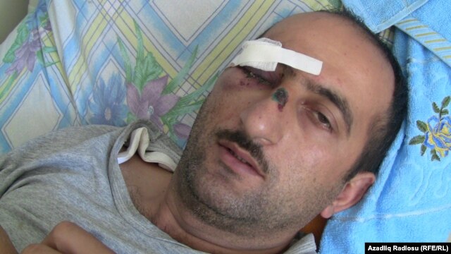 Journalist Idrak Abbasov was beaten by state security agents in April.