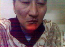 Shalkar Orazalin, from a video of him sewing his mouth shut (see link below)