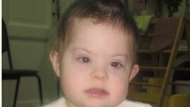 Даша (фото: www.usynovite.ru)