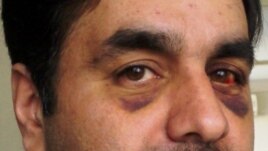 Javad Salimi, who says he was attacked and detained for trying to help a woman who was being attacked