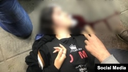تصویری که از دختر زخمی‌شده در رشت در شبکه‌های اجتماعی منتشر شد.