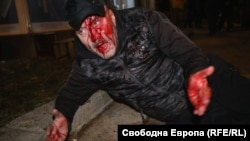Мъж в София, заснет след сблъсъка с полицията