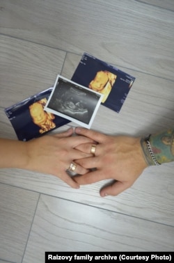 Фото УЗД з вагітністю Кирилом. Фото з особистого архіву родини