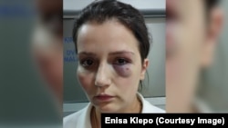 Enisa Klepo nakon što ju je pretukao vlasnik hotela Jablanica u kojem je radila. 