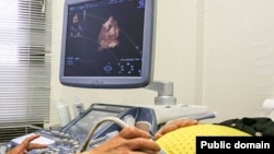 საილუსტრაციო ფოტო