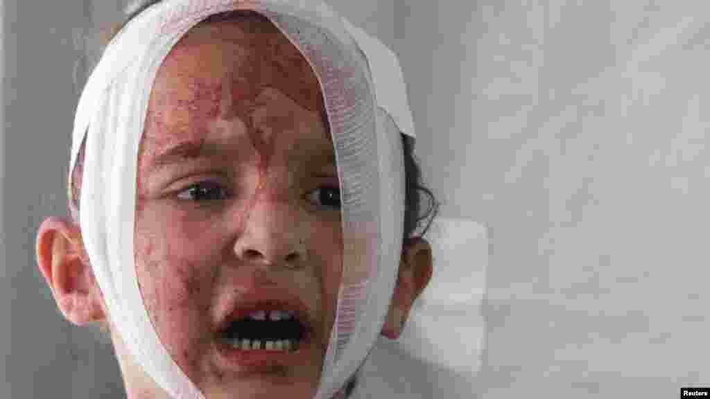 Izraeli tűzben megsebesült palesztin gyermek a Dzsabalia menekülttábor kórházában, a Gázai övezet északi részén 2024. május 13-án. Az izraeli csapatok ismét bevonultak&nbsp;Zeitún és Dzsabalia területére, ahol a hadsereg szerint a Hamász újraszerveződött mindössze öt hónappal azután, hogy állítása szerint felszámolta a csoport helyi zászlóaljait