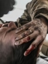 UKRAINE-RUSSIA-CONFLICT-WAR