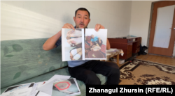 Сагындык Нурымбетов утверждает, что в Узбекистане его пытали сотрудники сил безопасности. Он показывает фотографию со следами пыток. Актобе, 18 ноября 2023 года