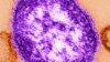 Qızılca virusu hissəciyinin mərkəzinin elektron mikroskop şəkli