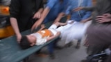 <div>
<div>
<div>
<div>A boy who was injured in a roof collapse due to torrential rains is shifted to a hospital in Jalalabad, Afghanistan. At least 35 people were killed and 230 injured in eastern Afghanistan after heavy rain caused by thunderstorms led to collapsed trees, walls, and roofs of houses.</div>
</div>
</div>
</div>
<div>&nbsp;</div>
